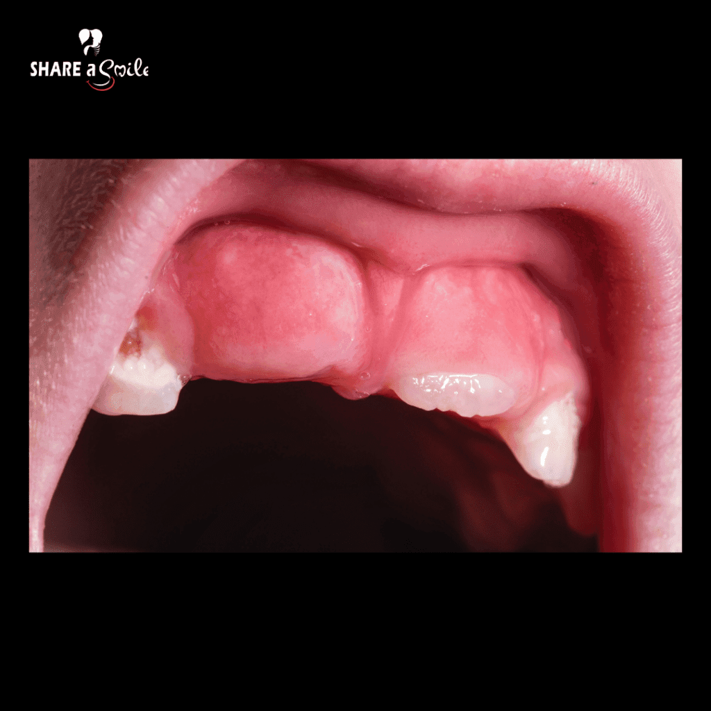 pediatric dentist in pandalam