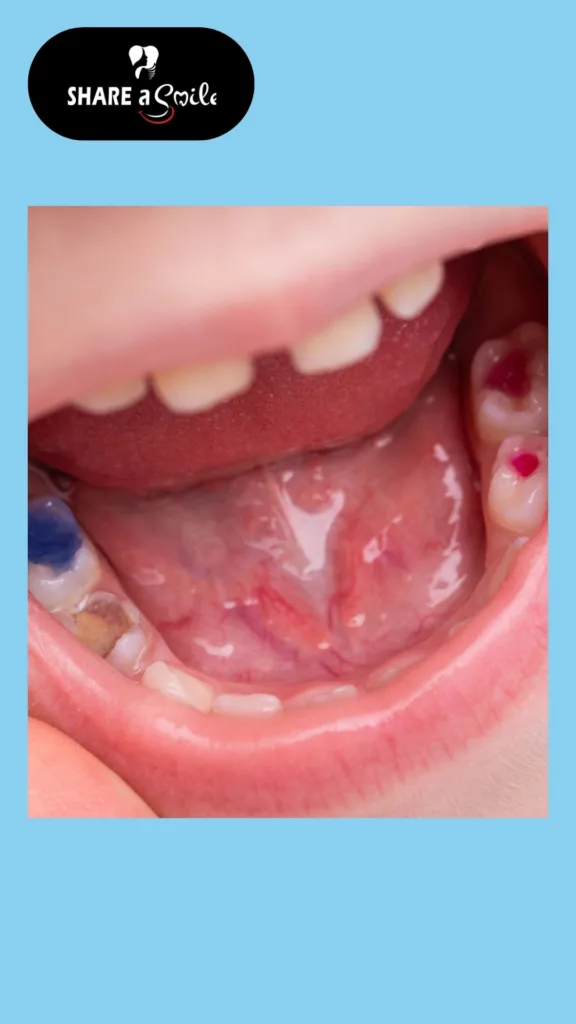 pediatric dentist in pandalam