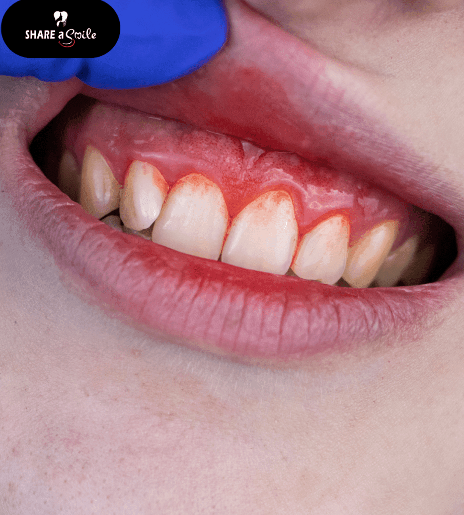 gum treatment in pandalam, pathanamthitta, kerala