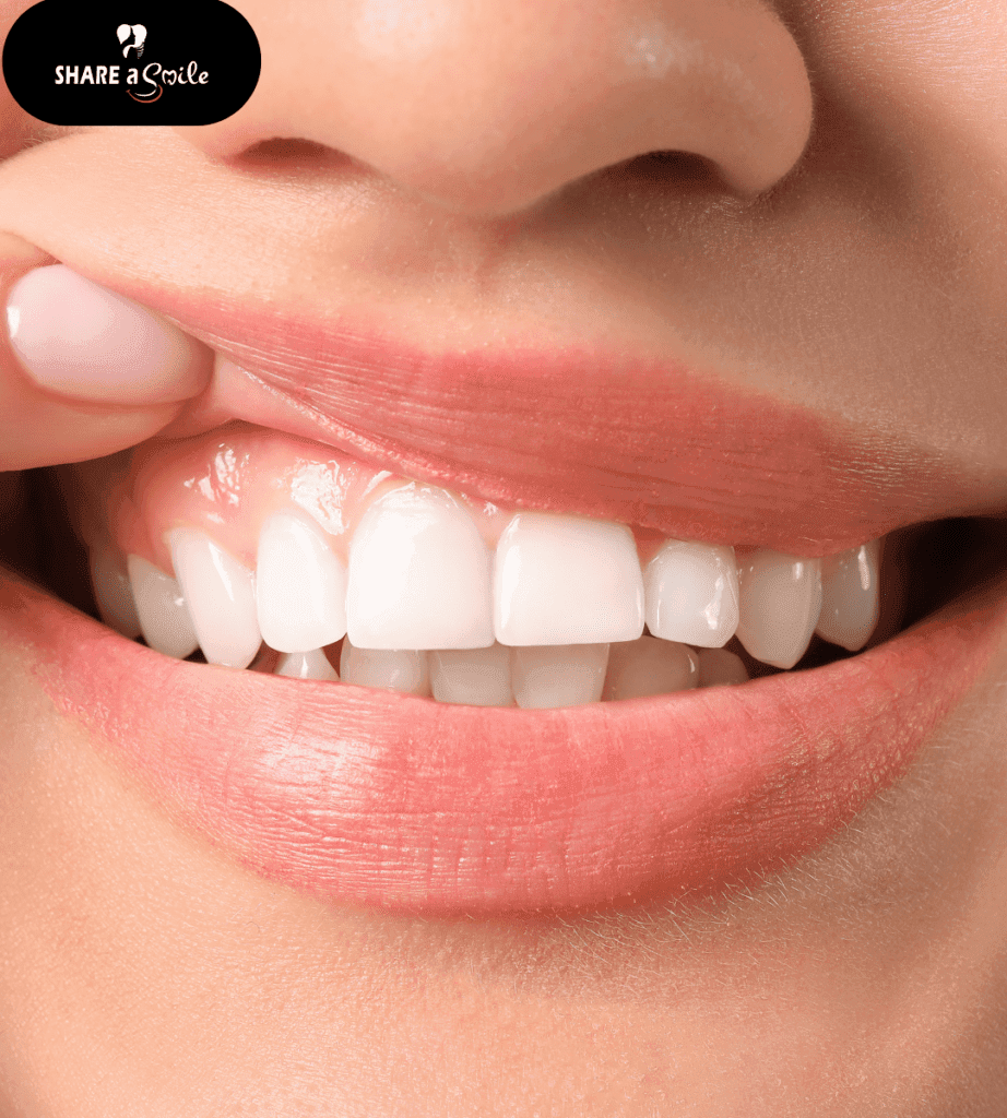 aesthetic dentistry in pandalam