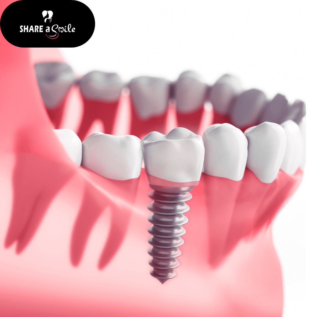 dental clinic in kerala