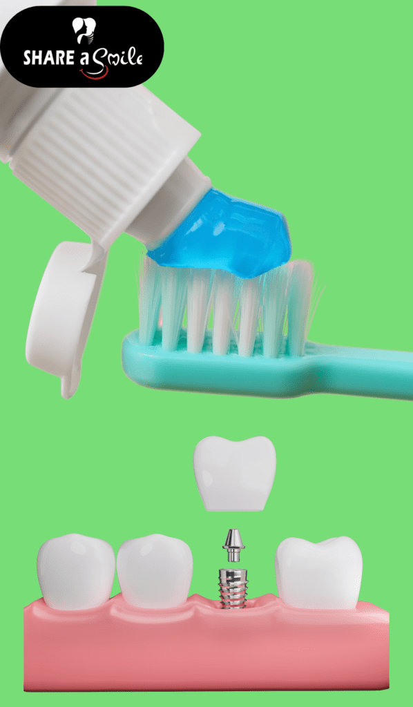 dental implantology at share a smile