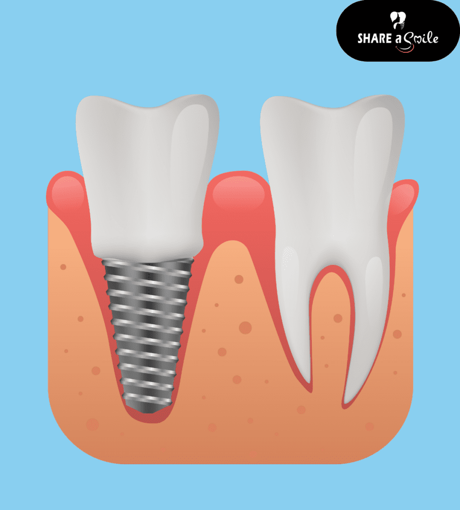 dental clinic in kerala
