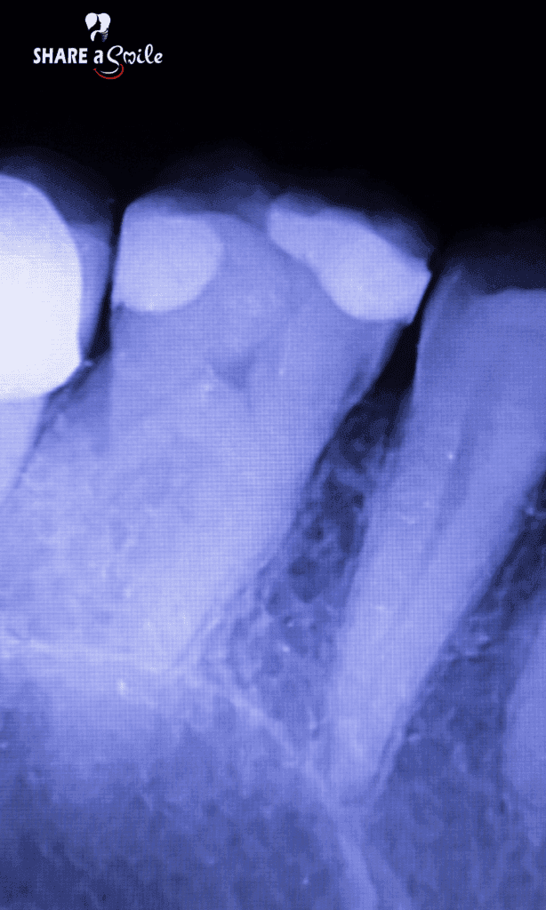 dental xray in adoor