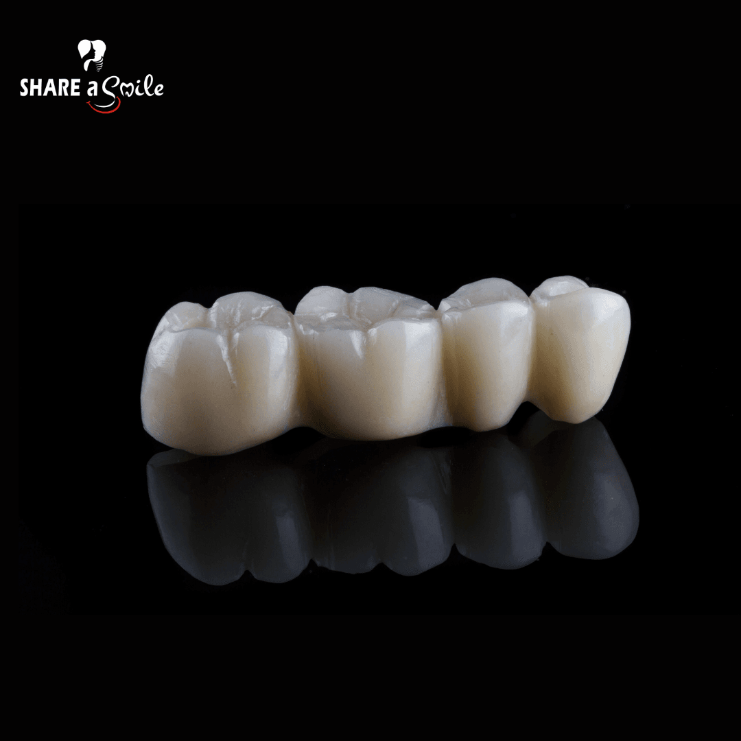 Unveiling the Magic of Zirconia Crowns and Bridges for a Seamless Smile