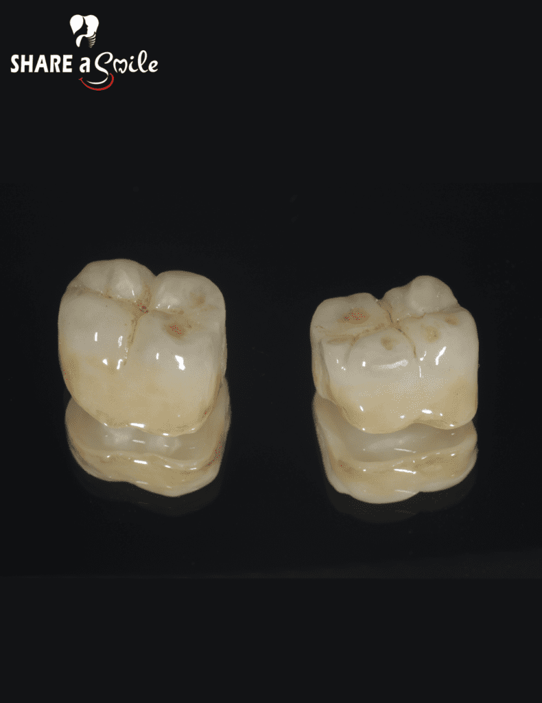 aesthetic dentistry in pandalam, Adoor, Pathanamthitta