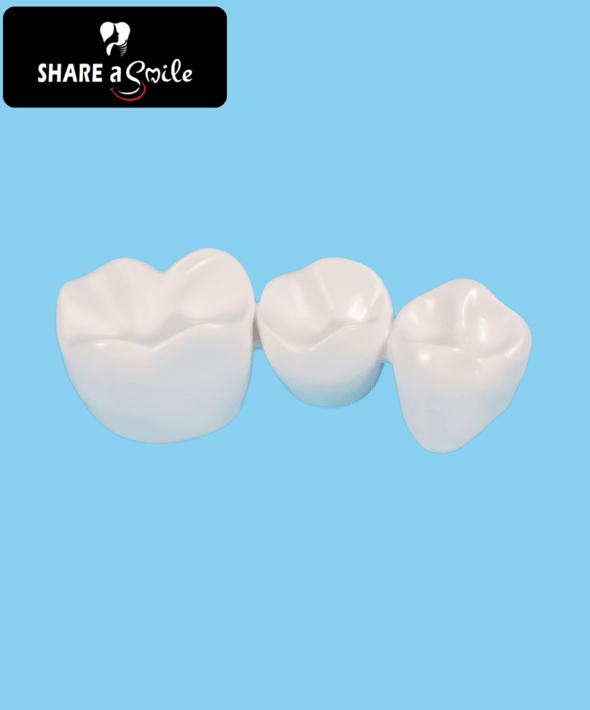 crowns and veneers in Pandalam