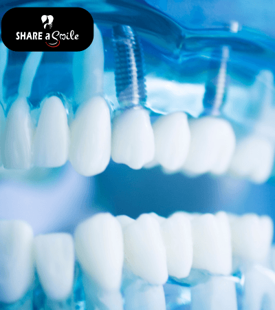 tooth restoration in Pandalam, pathanamthitta