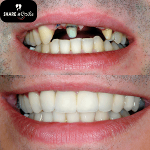 dental clinic in pandalam, pathanamthitta