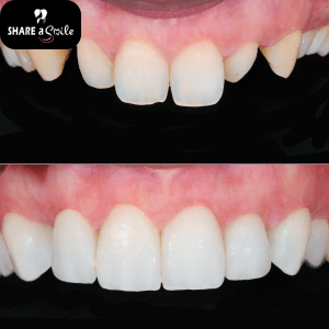 smile designing in pandalam, pathanamthitta