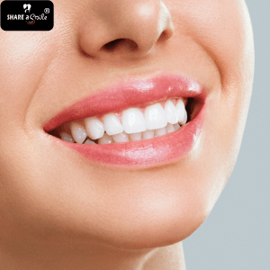 tooth whitening in pandalam, pathanamthitta